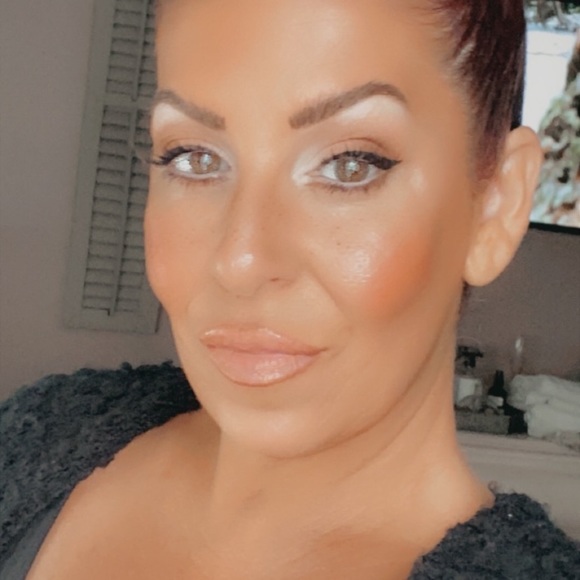 SALE 125$ - - Linetox 100 units plus filler - Picture 4 of 6